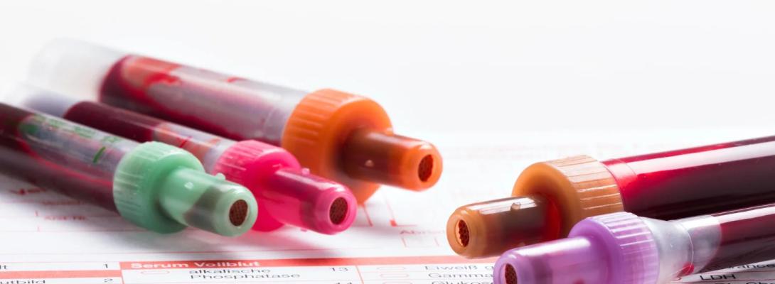 Дожити до 100 років реально: вчені з’ясували, яка група крові дає перевагу