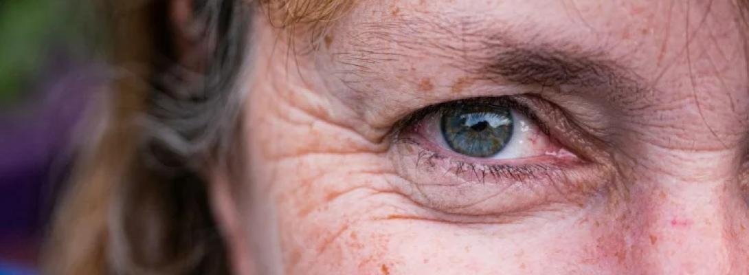 Їжа, що руйнує молодість: як звичний продукт прискорює старіння і появу зморшок 