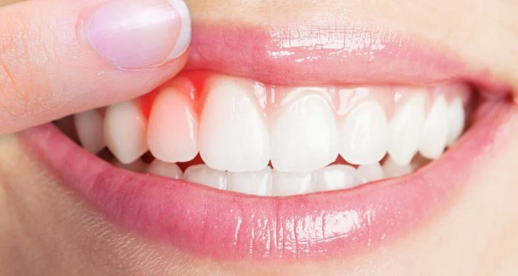 Секрети довгого життя приховані у вашій усмішці: як стан ясен впливає на весь організм