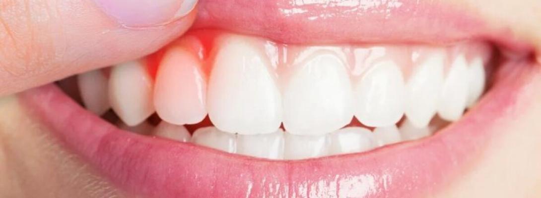 Секрети довгого життя приховані у вашій усмішці: як стан ясен впливає на весь організм