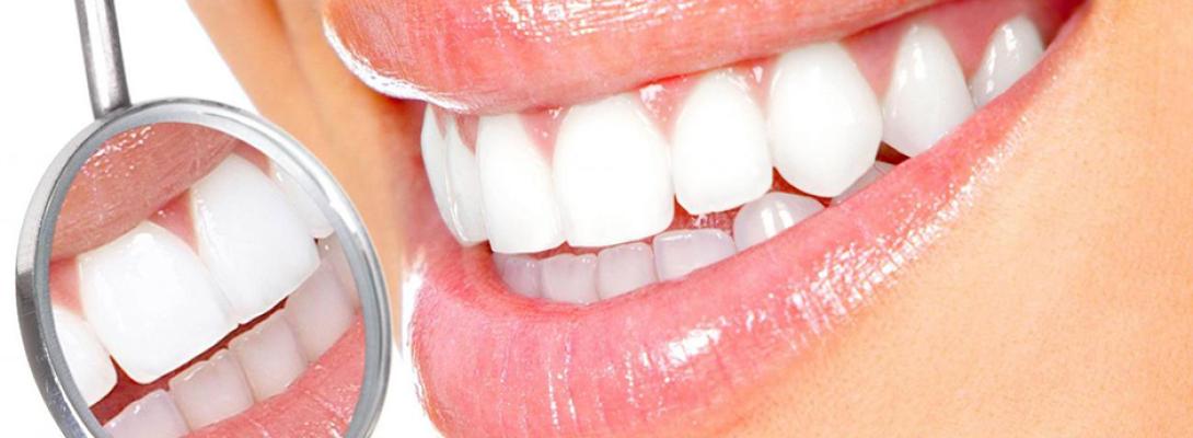 Як зберегти білосніжну усмішку: поради стоматолога для щоденного догляду за зубами