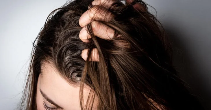 Жирне волосся більше не проблема! Секрети швидкого й простого догляду вдома