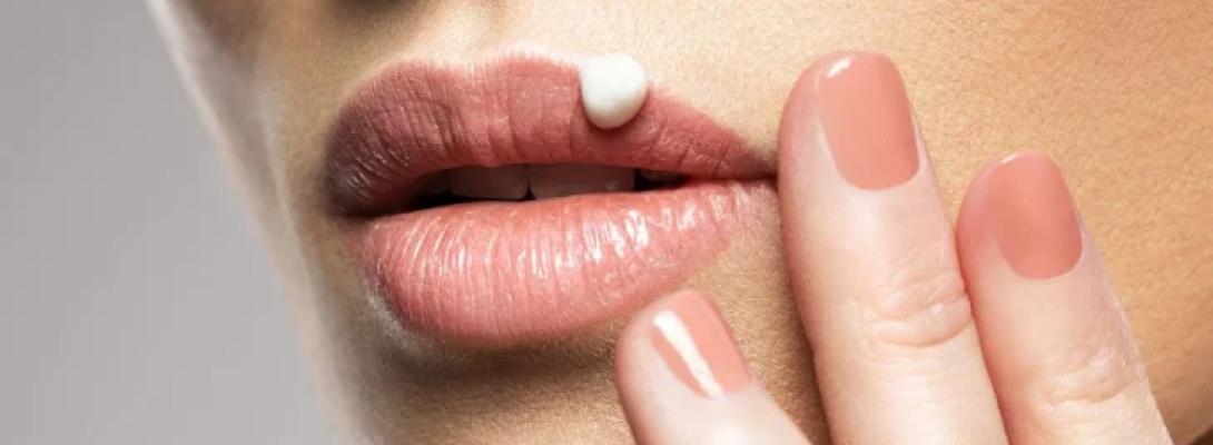 Чому виникає герпес на губах і що робити, щоб він пройшов максимально швидко