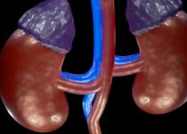 Небезпека, про яку мовчать: це популярне знеболювальне поступово "вбиває" ваші нирки