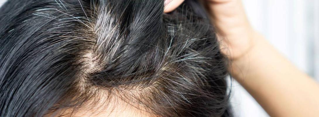 Чому з’являється сивина і як повернути природний колір волосся: практичні поради