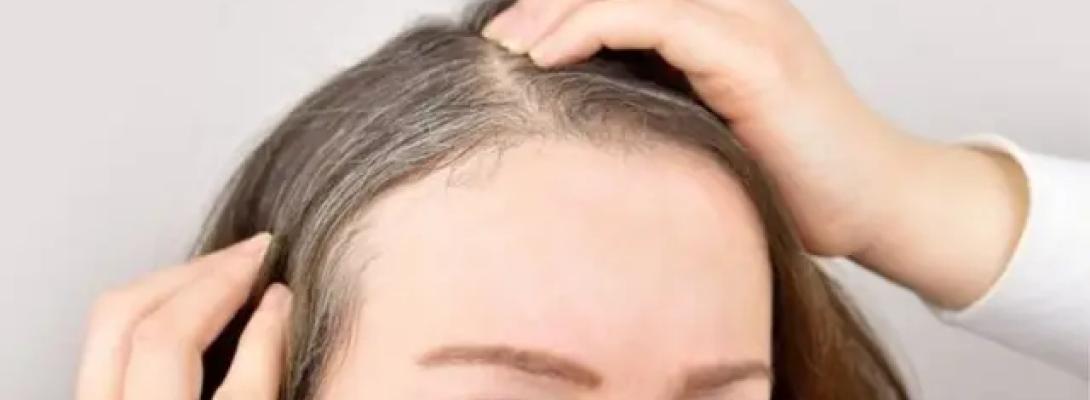 Сивина більше не проблема: перевірені способи приховати зміну кольору волосся 