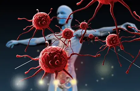 Лікування раку без операцій: що відомо про імунотерапію та її ефективність 