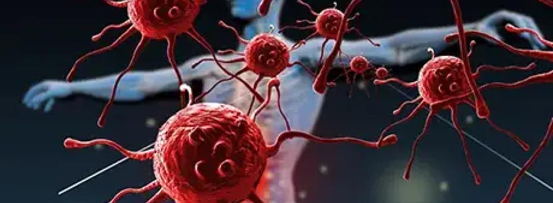 Лікування раку без операцій: що відомо про імунотерапію та її ефективність 