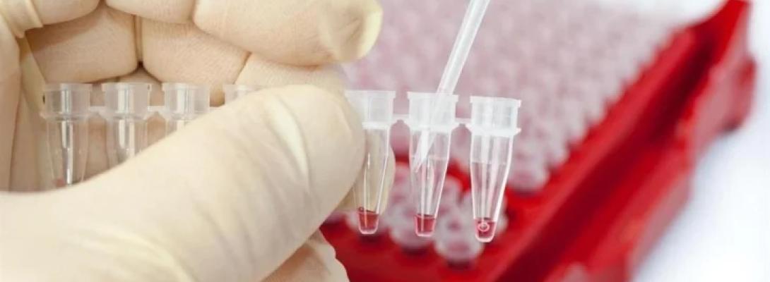 Британські вчені розробили метод, який виявляє рак задовго до перших симптомів