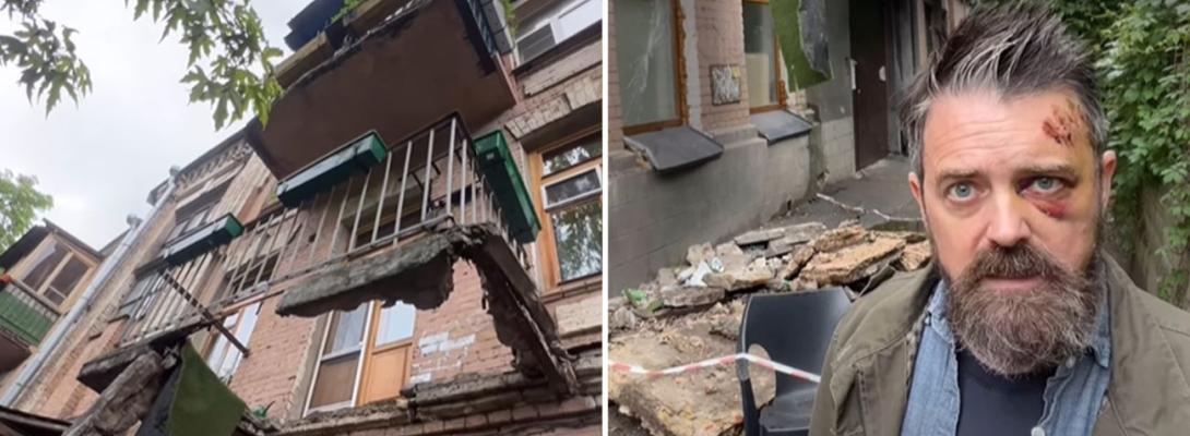 Жах у центрі Києва: балкон впав на американського режисера Крістофера Волтерса!