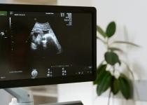 Чи можливо завагітніти ще раз, якщо ви вже очікуєте дитину: правда чи міф?