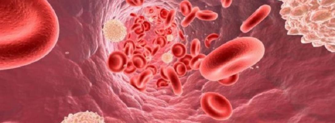 Як знизити високий рівень холестерину в крові без таблеток: перевірені методи