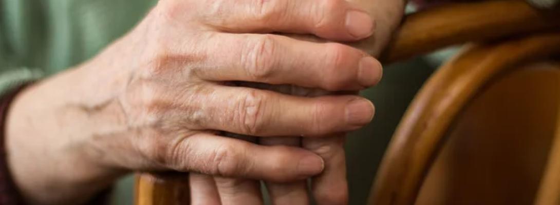 Лікар назвав продукт, який врятує від артриту: простий спосіб зберегти здорові суглоби