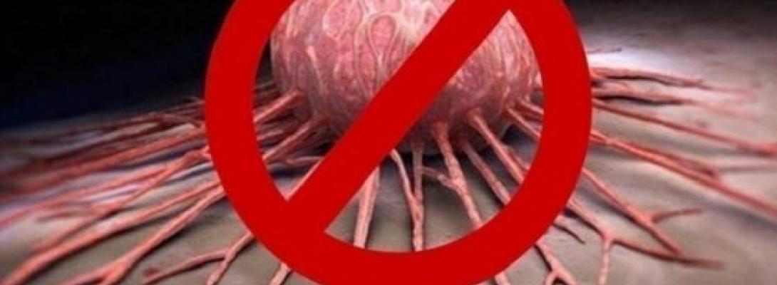 Науковці назвали шість поширених звичок, які підвищують ризик захворіти на рак
