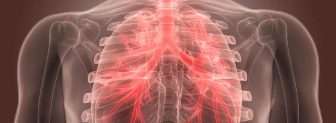 Тривалий кашель після бронхіту: коли це норма, а коли варто звернутися до лікаря