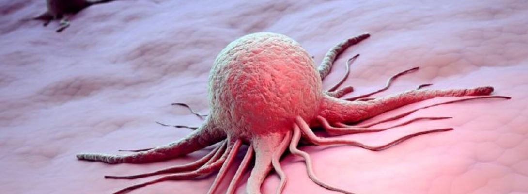 Онкологи назвали звички та умови життя, які значно підвищують ризик розвитку раку