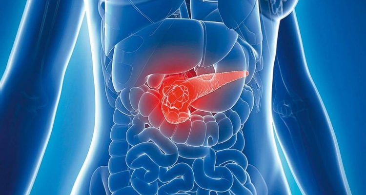 Лікарі попереджають: ці малопомітні симптоми вказують на рак підшлункової залози