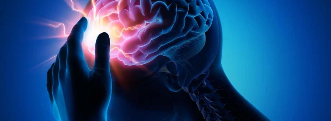 Вчені назвали перелік продуктів, споживання яких може знизити ризик інсульту на 80%